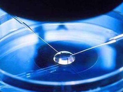 盘点新加坡做三代试管，一文说清可不可靠